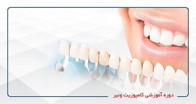 کامپوزیت ونیر-(ویژه دندانپزشکان)